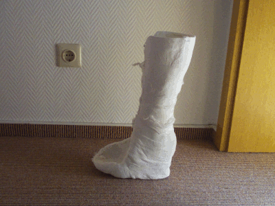 Bild "Willkommen:Achillessehne_Gips_.gif"